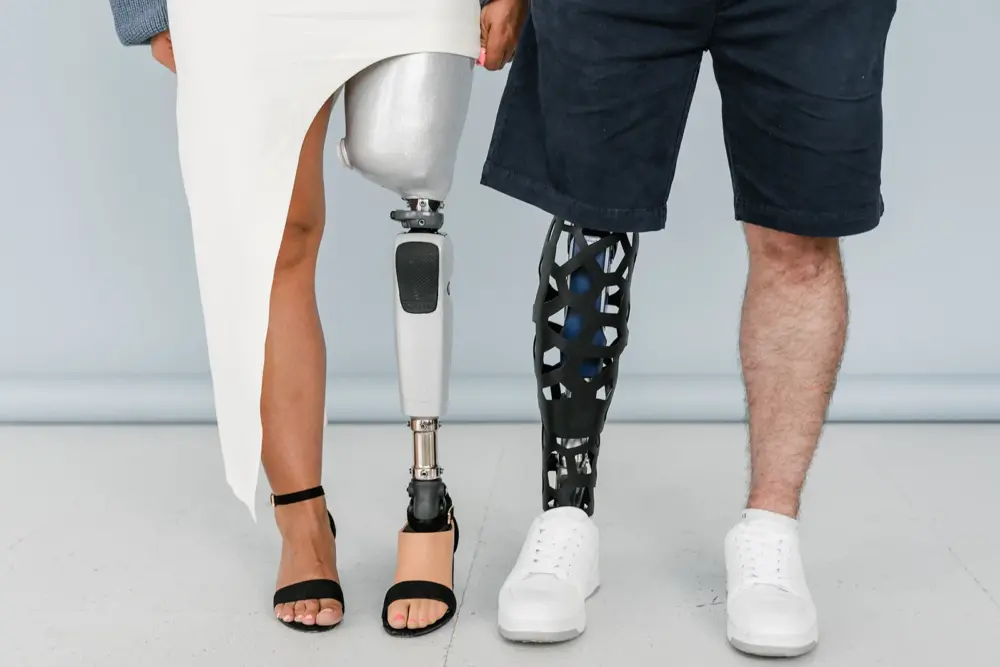 WebRNS Amputee Prosthetic Leg1